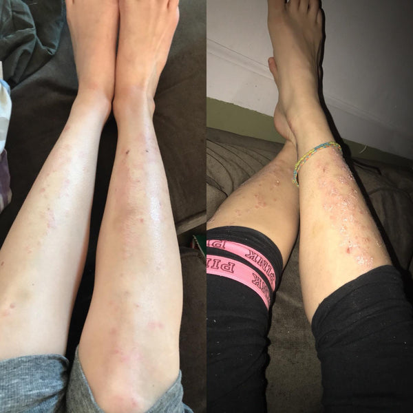 Customer review photo