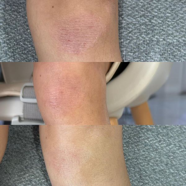 Customer review photo