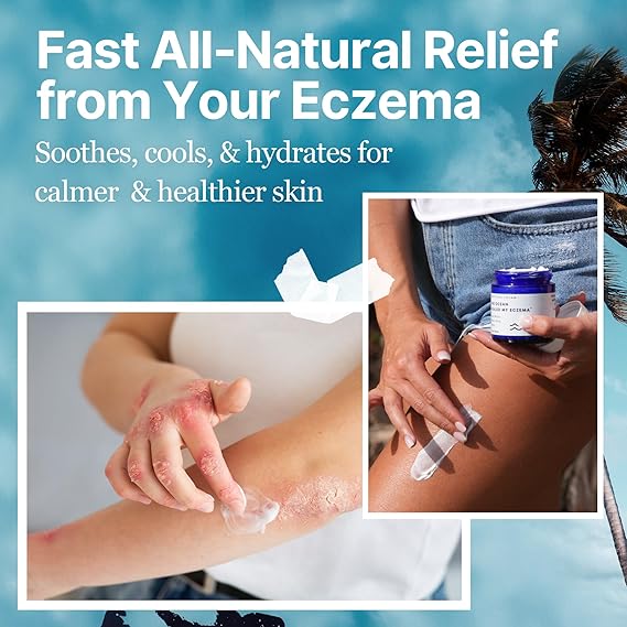 The Ocean Healed My Eczema Natural & Soothing Eczema Cream